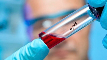 پیوند سلول‌های بنیادی خون‌ساز به کودکان را تجهیزات ایران‌ساخت ممکن کرد